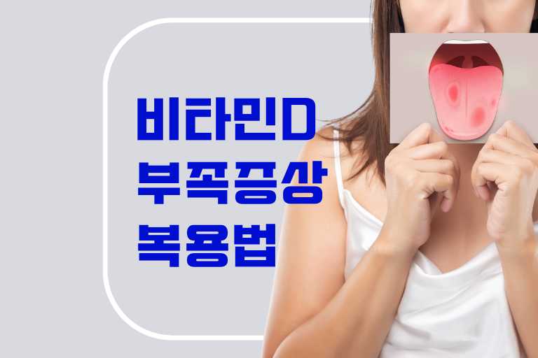 비타민D 부족 증상과 복용법