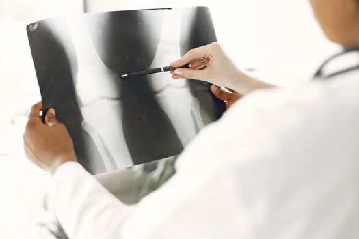 뼈 관절 근육 건강 보스웰리아 콘드로이친 복용